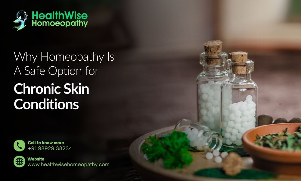 Why Homeopathy Is a Safe Option for Chronic Skin Conditions